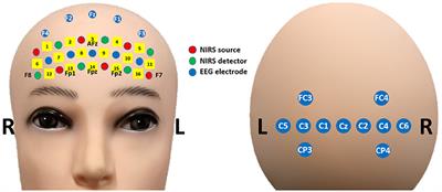 A Ternary Hybrid EEG-NIRS Brain-Computer Interface for the Classification of Brain Activation Patterns during Mental Arithmetic, Motor Imagery, and Idle State